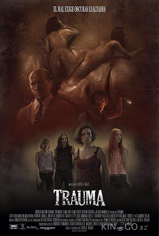 Травма 